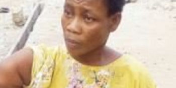 Mrs. Bose Olasukanmi, whose right arm was used by various pastors to perform fake miracles