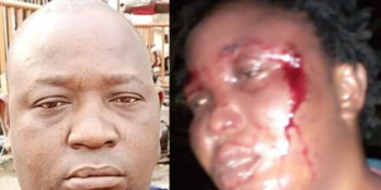 Sulaiman Maiyegun and battered wife, Mariam