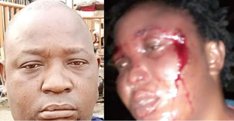 Sulaiman Maiyegun and battered wife, Mariam