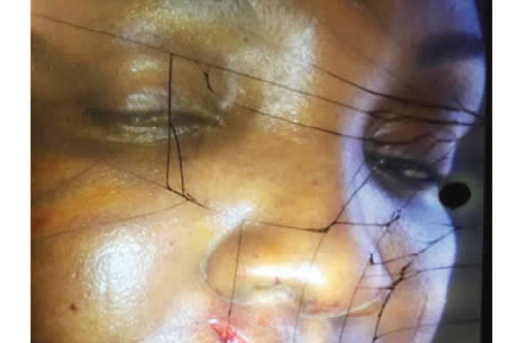 Victim of police brutality in Lagos, Nigeria